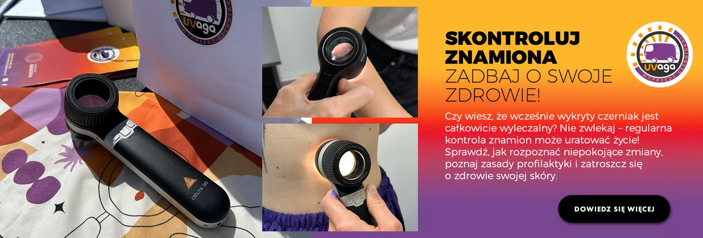 Skontroluj znamiona